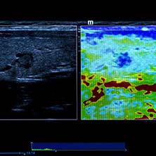 Elastography Atlanta, GA